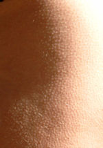 Goose bumps are an example of a vestigial human reaction to stress.