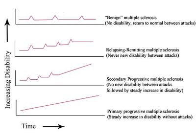 Graph representing the different types of multiple sclerosis