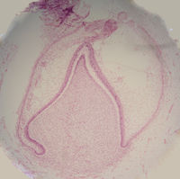 Histologic slide of tooth in late bell stage. Note disintegration of dental lamina at top.