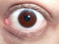 This image clearly shows the pupil, iris, and blood vessels of the human eye.