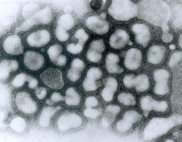 Influenza A virus, the virus that causes Avian flu. Transmission electron micrograph of negatively stained virus particles in late passage. (Source: Dr. Erskine Palmer, Centers for Disease Control and Prevention Public Health Image Library)