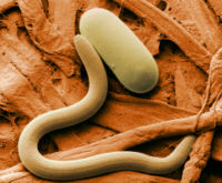 Soybean cyst nematode and egg